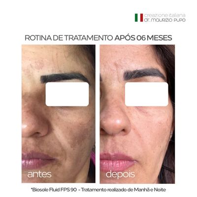 Protetor Solar 12HS Fluido Anti-Manchas Biosole Fluid FPS 90