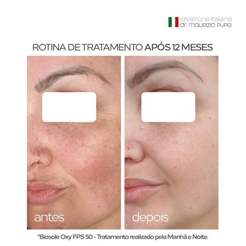 Protetor Solar Facial Biosole Oxy FPS 85 com Vitaminas C e Niacinamida para Peles com Melasma