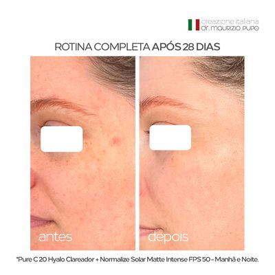 Protetor Solar 12HS Pele Oleosa Normalize Matte Intense FPS 50