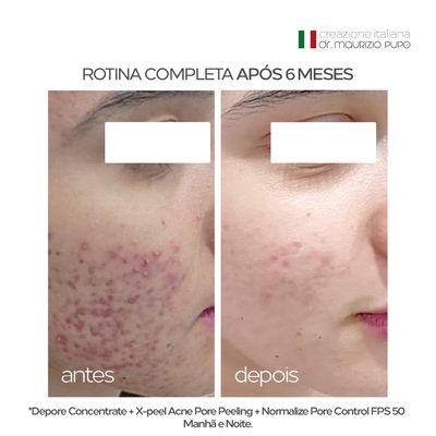 Kit 2 Unidades Protetor Solar 12HS  Antiacne Normalize Pore Control FPS 50