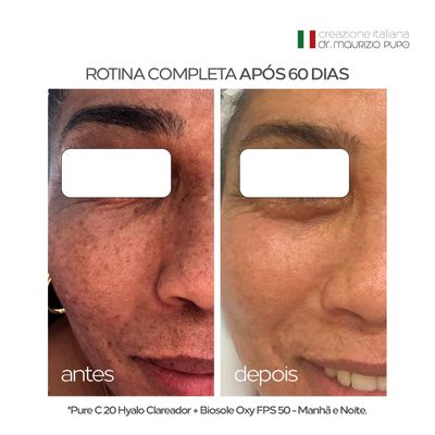 Pure C 20 Hyalo Clareador com Vitamina C Pura 20% e Ácido Hialurônico